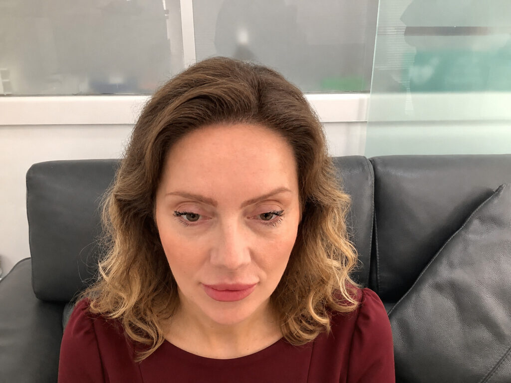 Woman with wavy hair during consultation at The Skin and Hair Clinic.