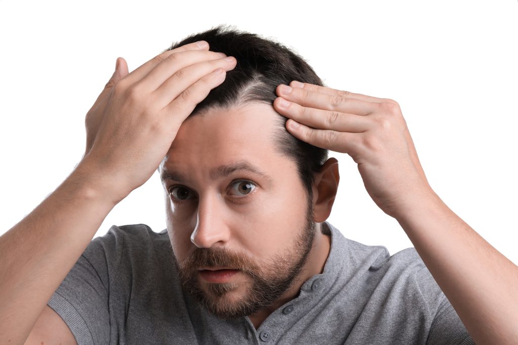 Man examining his scalp after hair treatment or hair loss concern.