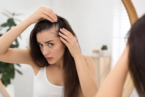 Receding Hairline in Women: Causes, Signs and the Best Treatment Options