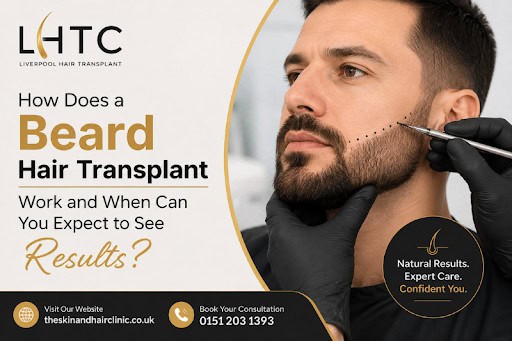 How Does a Beard Hair Transplant Work and When Can You Expect to See Results?